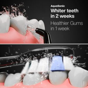 AquaSonic Home Dental Center PRO: A Neutral Review of the Toothbrush + Water Flosser Set
