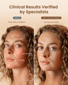 RENPHO 4D Red Light Therapy Mask: A Neutral Review of the At-Home LED Face Mask