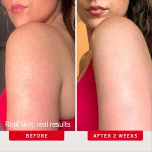 First Aid Beauty KP Bump Eraser Body Scrub (10 oz): A Neutral Review of the Full-Size KP Exfoliator