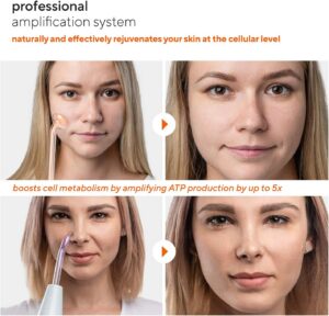 NuDerma Professional High-Frequency Wand: A Neutral Review of the 6-Electrode Skin Therapy Kit