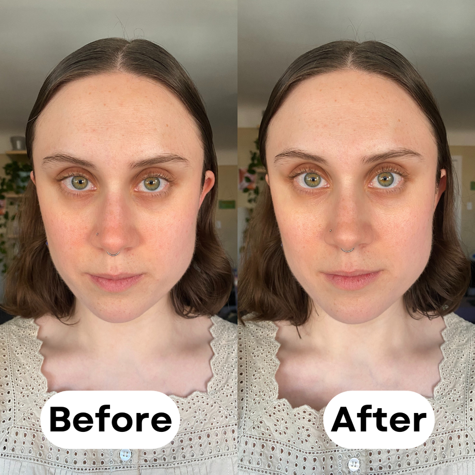 Best Under Eye Cream For Bags