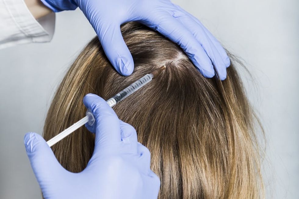 Doctor giving hair loss treatments