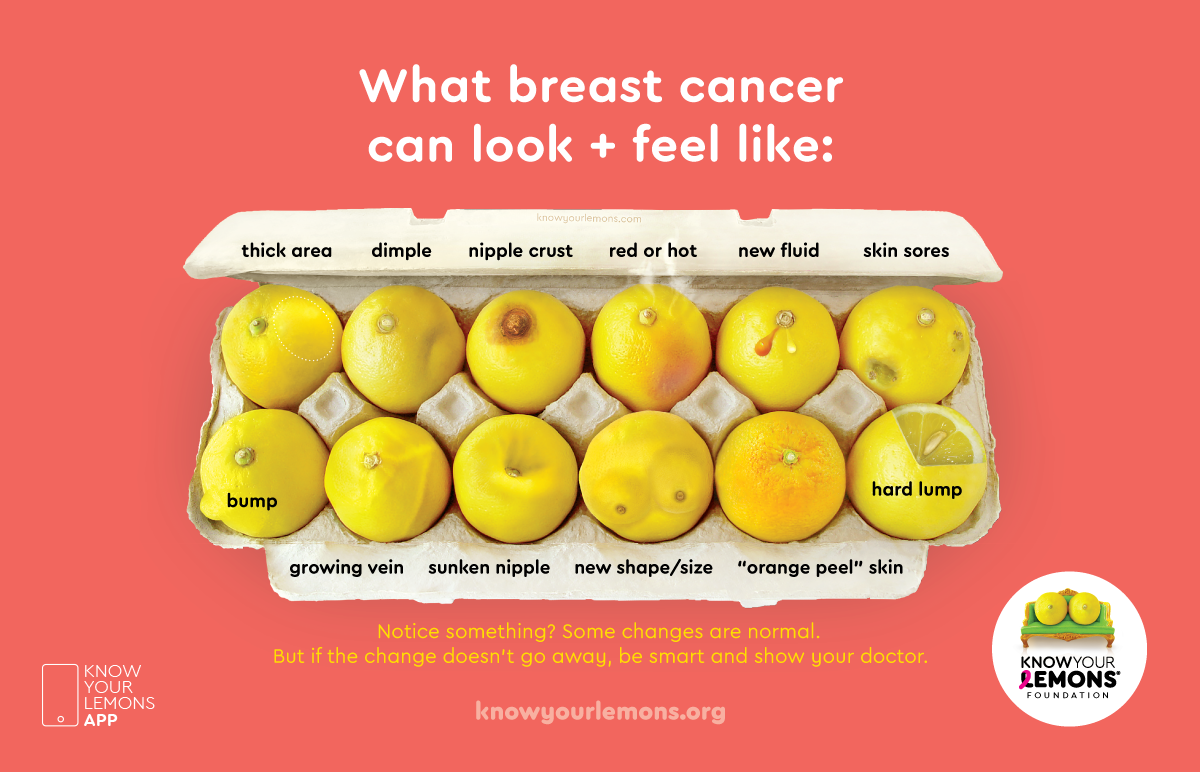 know your lemons signs of breast cancer infographic