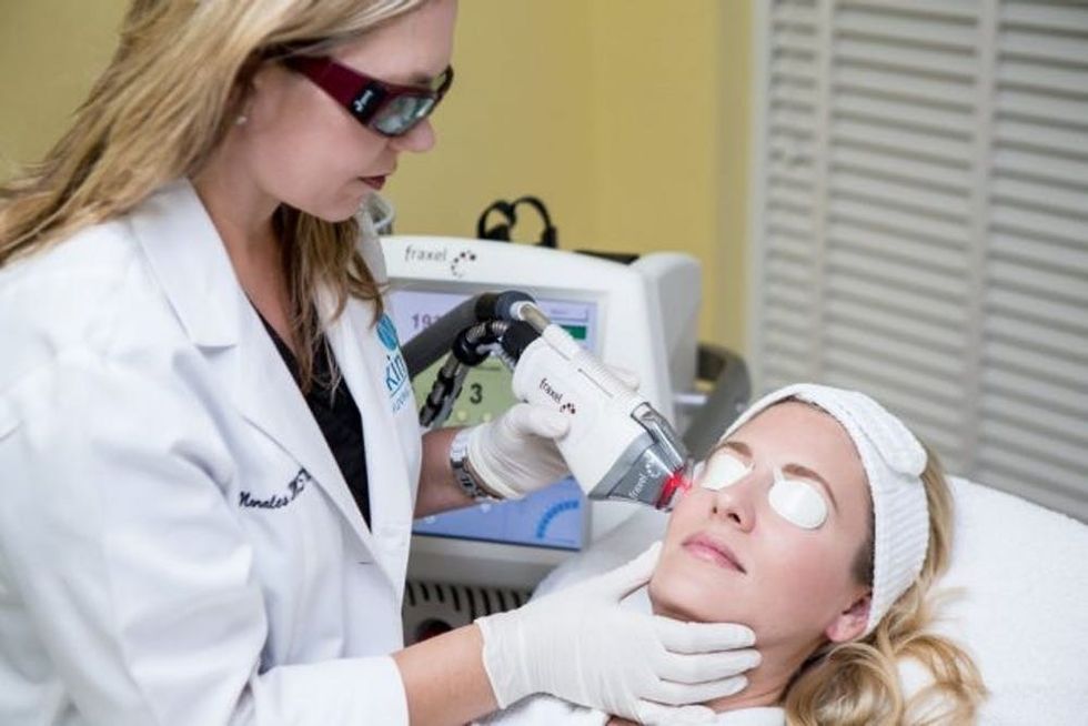 fraxel-laser-treatment-south-tampa