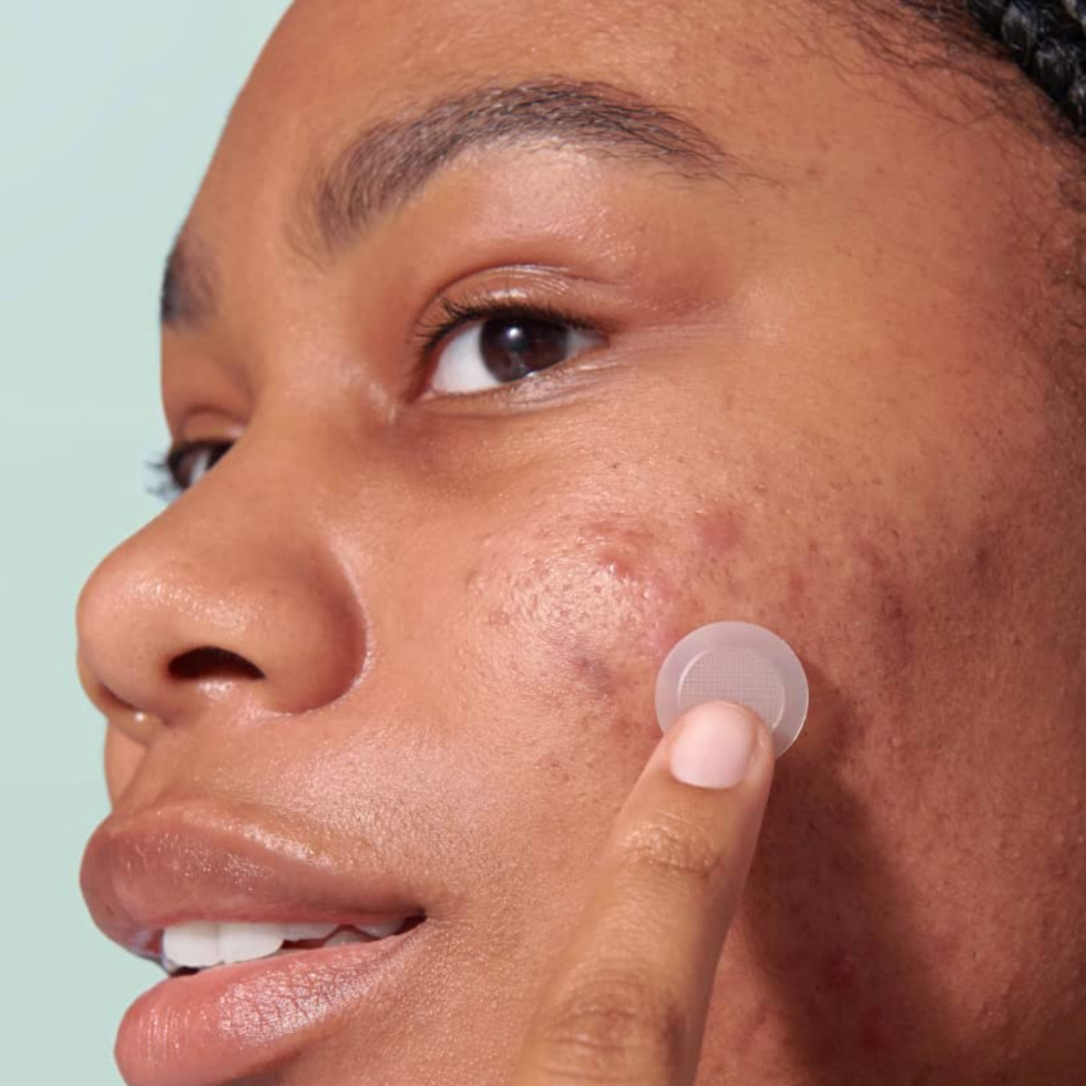 Hero Pimple Patches Review