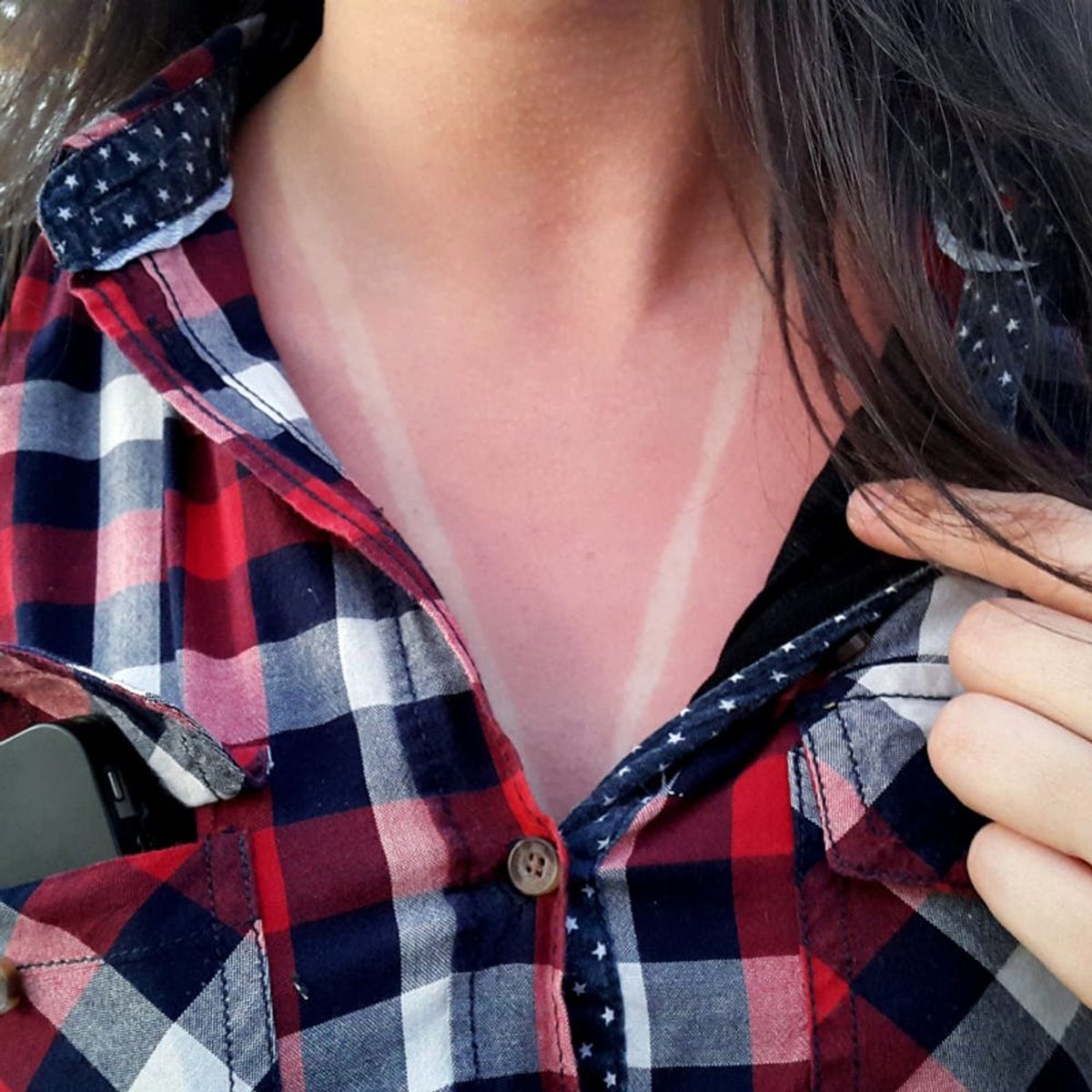 8 Dos and Don’ts Of Treating a Burn