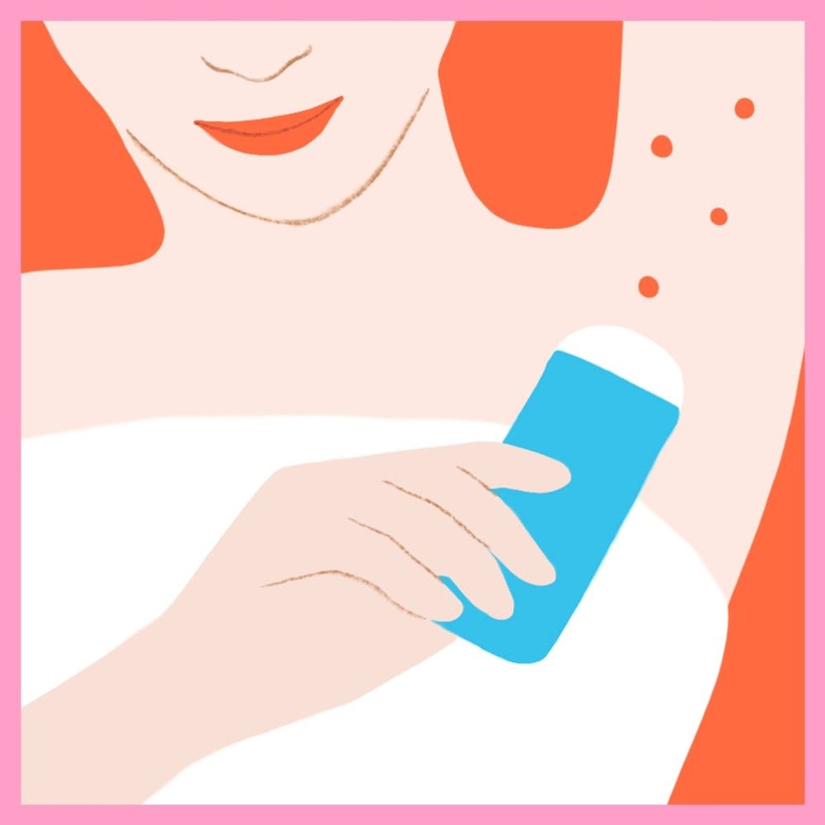 Why Is My Natural Deodorant Causing My Underarms to Break Out?