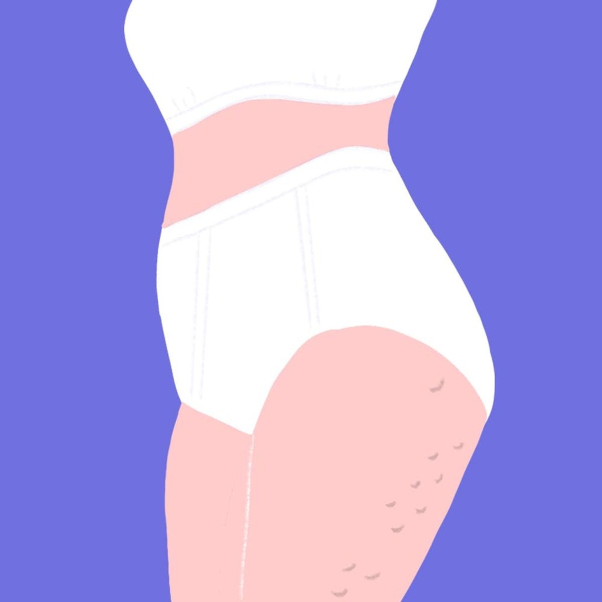 Which Cellulite Treatments Actually Work?