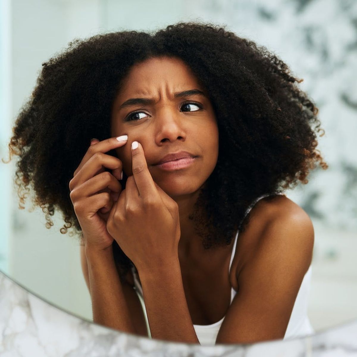 This Diet Supplement Could Change the Way We Treat Acne for Good