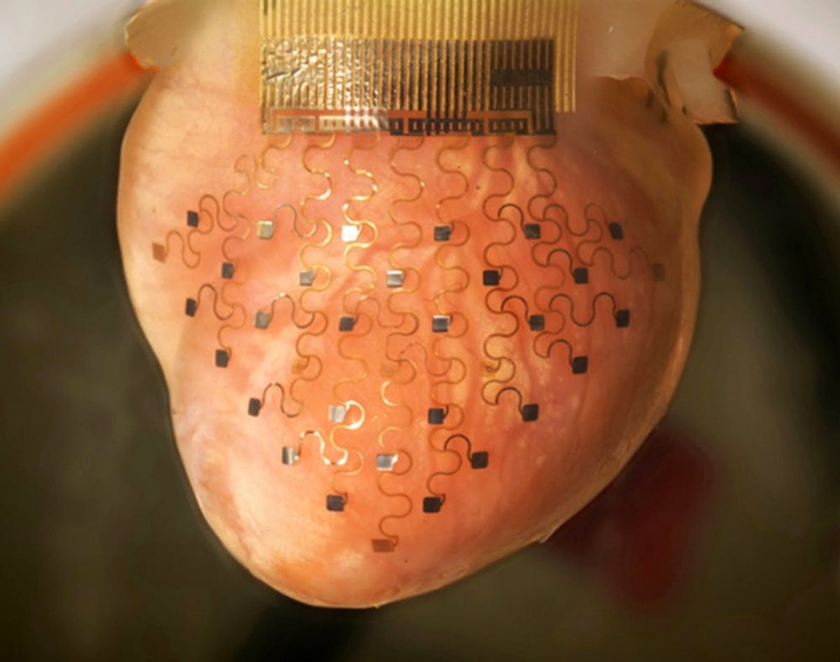 Here’s How You Can Stop Heart Attacks With a Smartphone