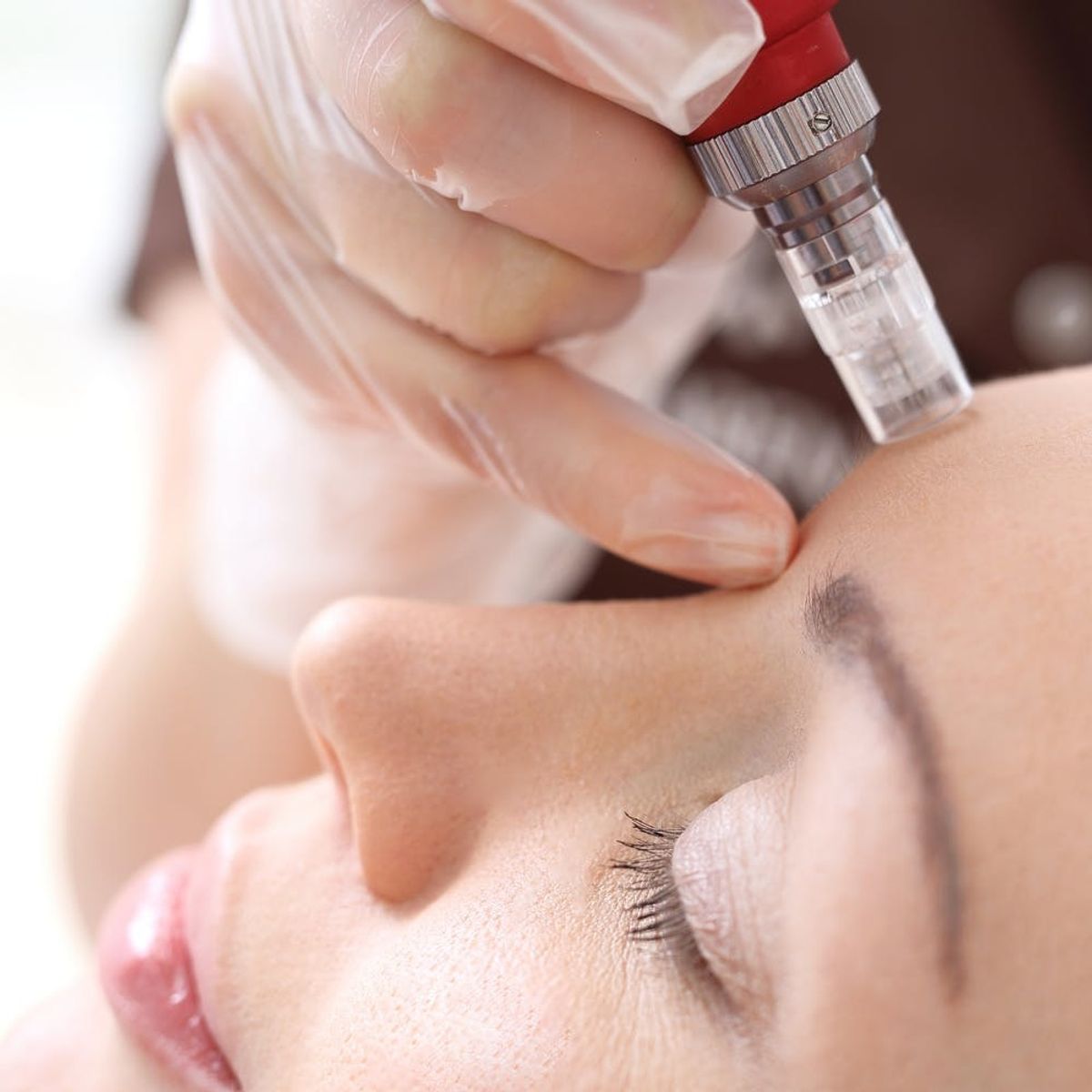 This New Microneedling Facial Might Replace the Vampire Facial