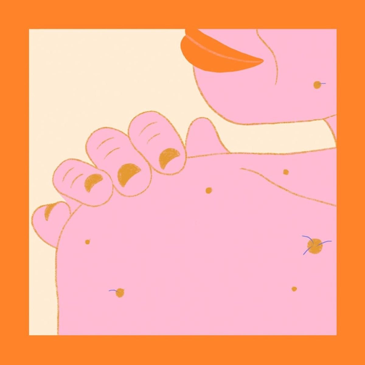 Can I Shave or Pluck My Hairy Moles?