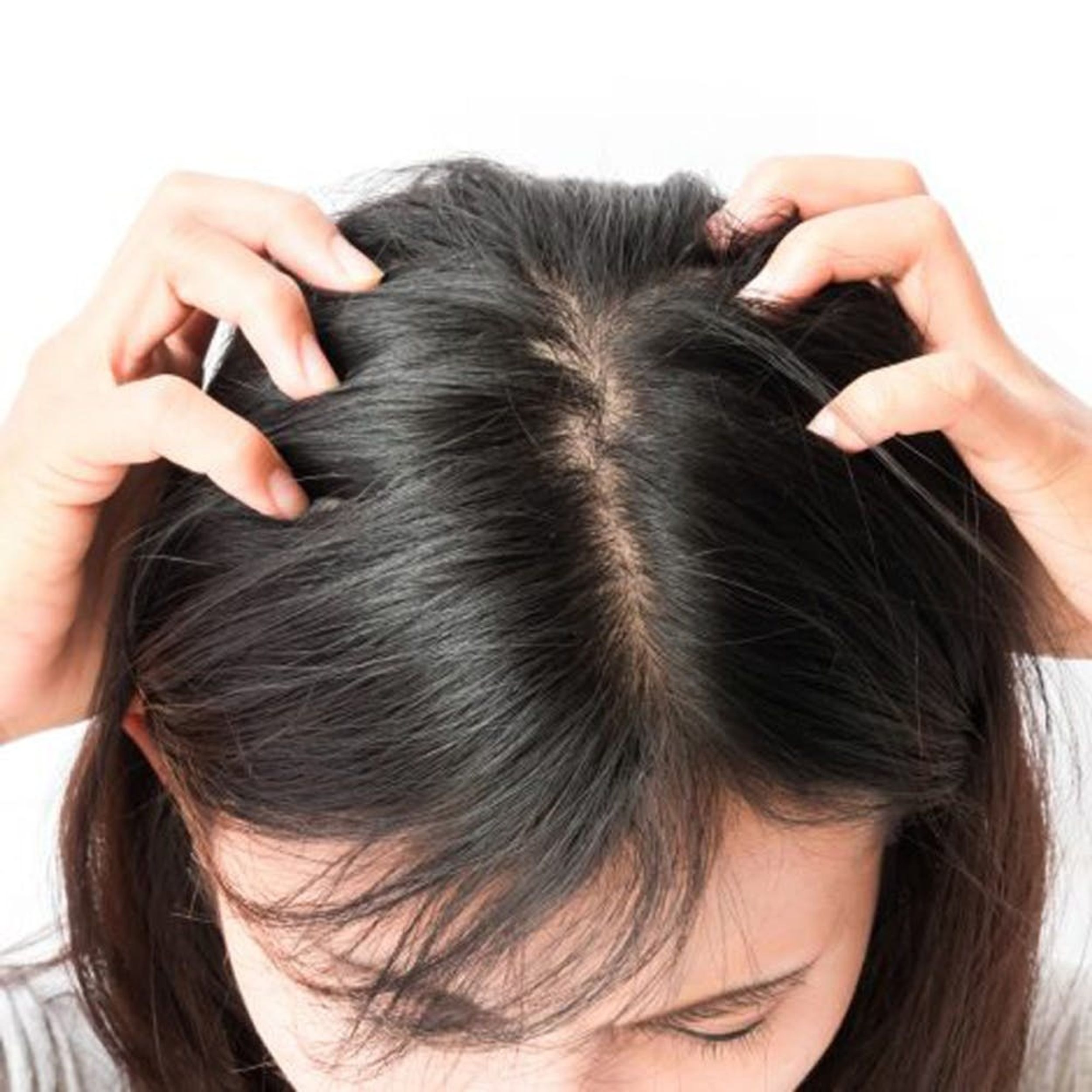 How to Treat Scalp Zits, According to Experts