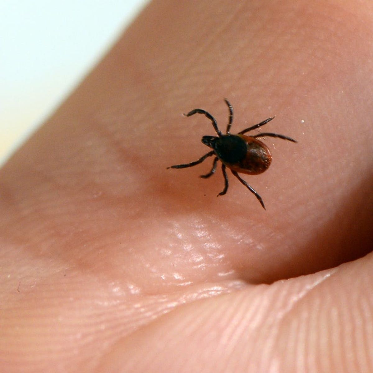 Lyme Disease Is Scary and on the Rise – How to Protect Yourself from Ticks