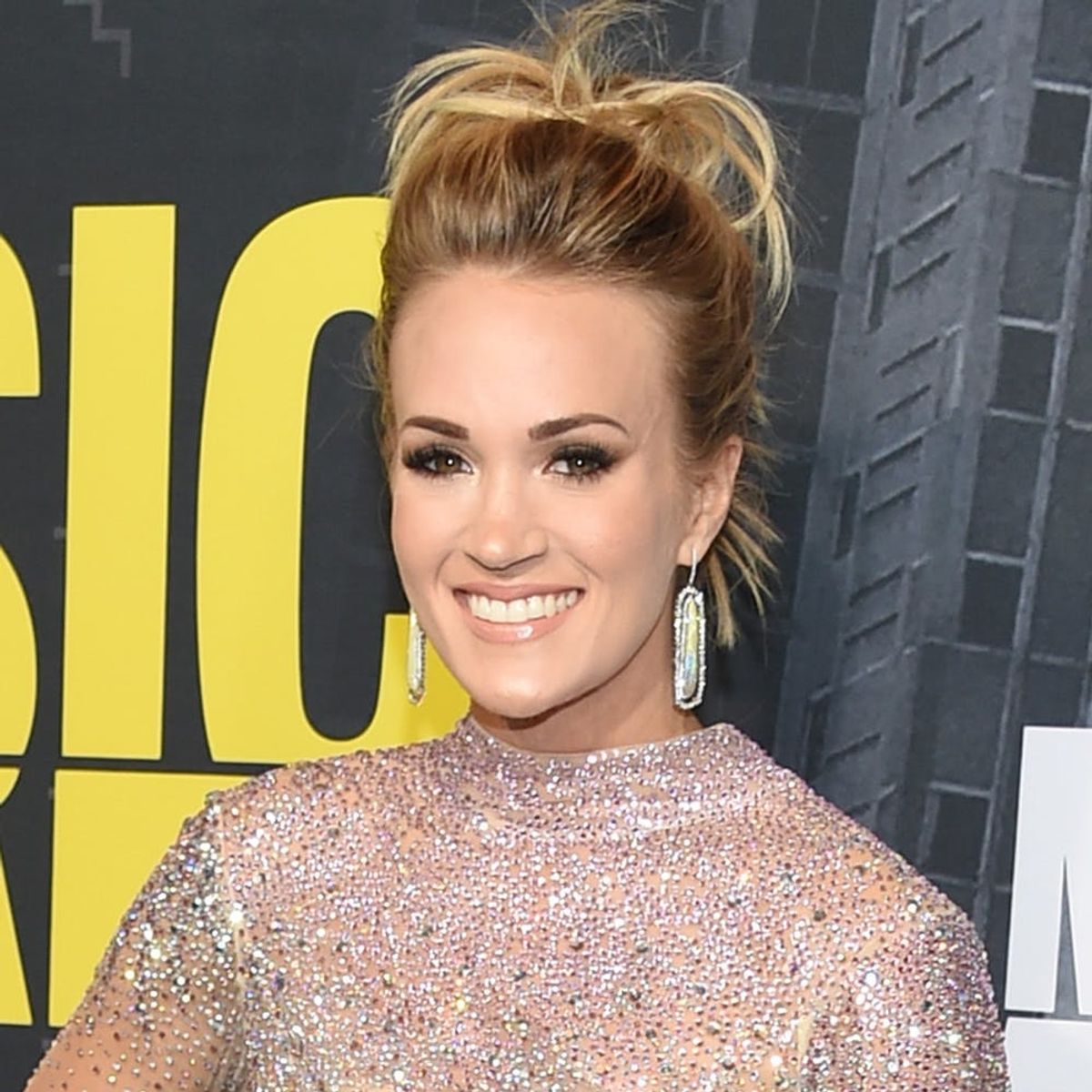 Carrie Underwood Opens Up About Her Face Injury and Recovery