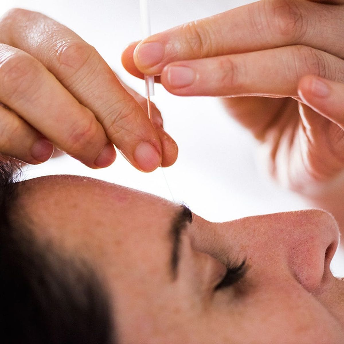 4 Ways Acupuncture Can Improve Your Appearance