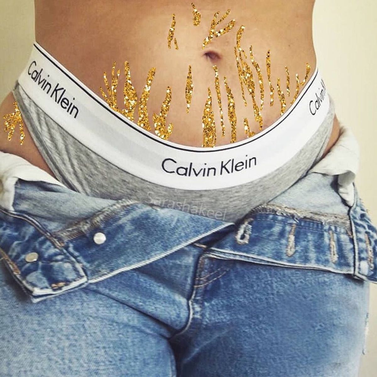 This Artist Celebrates Stretch Marks With Glitter and Imagination