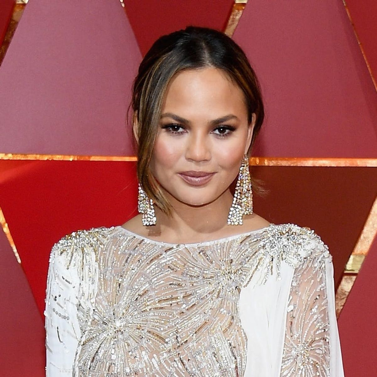 Here’s the Genius Way Chrissy Teigen Covered Up a Leg Burn on the Red Carpet
