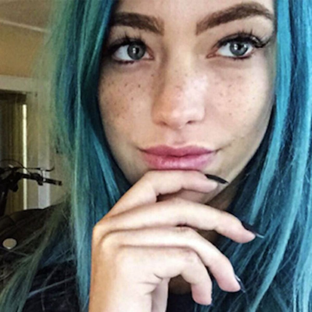 This Kickstarter Wants to Make Freckles an Accessory for Everyone