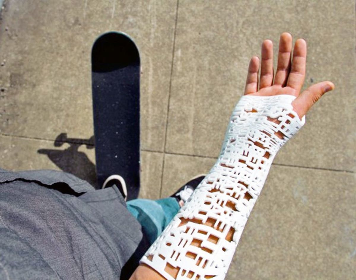 Now You Can 3D Print Messages into Your Cast
