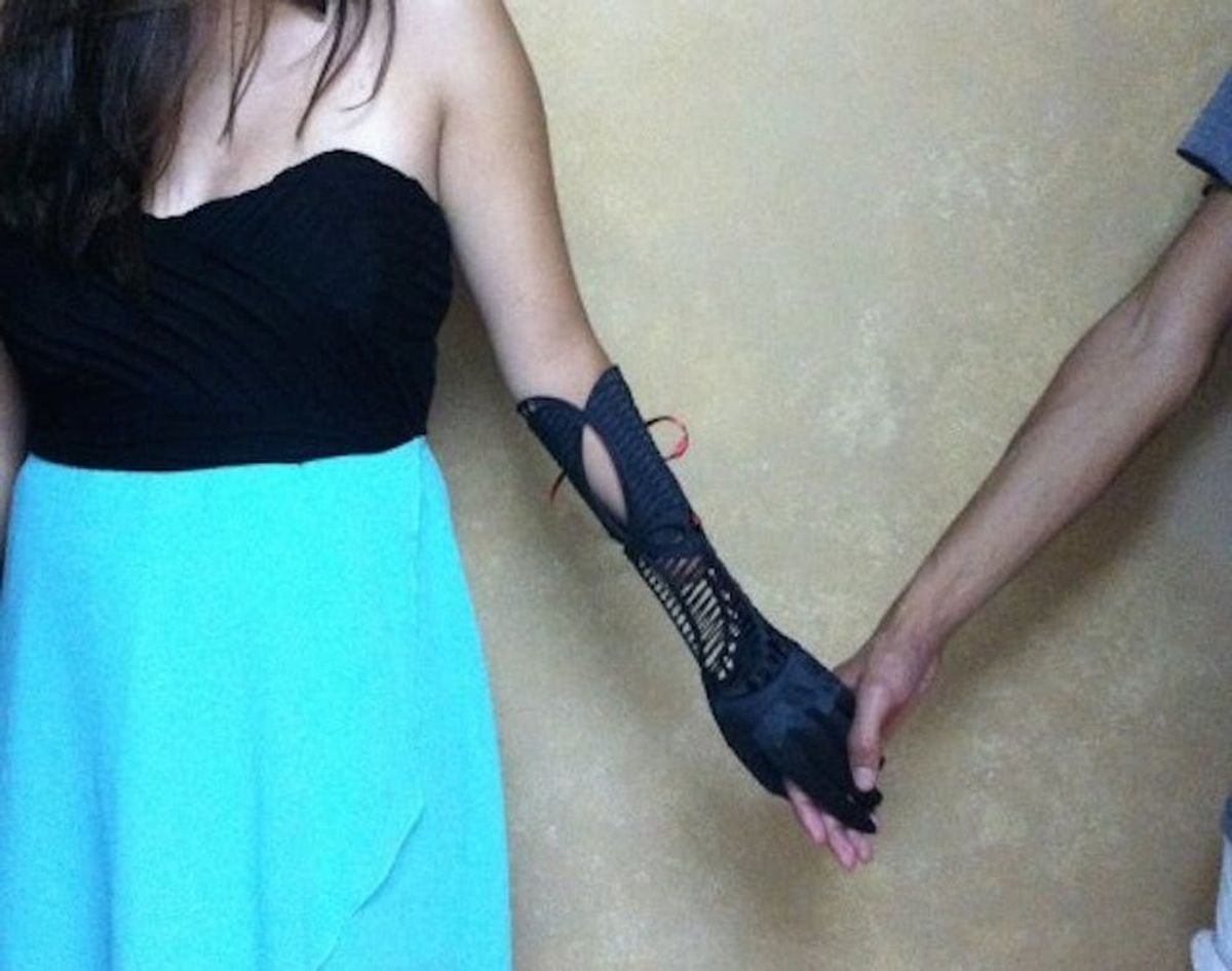 What Happens When an Art Student 3D Prints Prosthetics