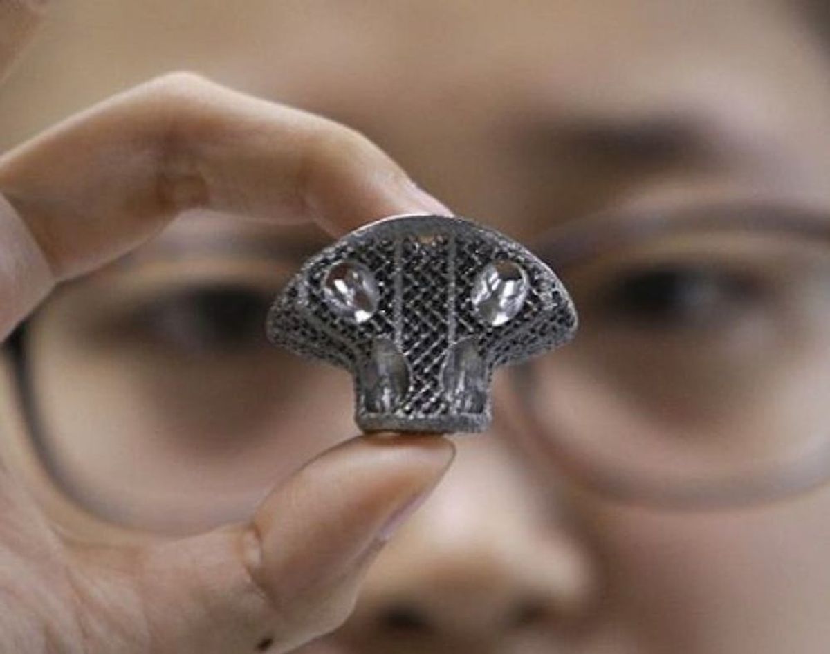 3D Printer Makes New Bones for 12-Year-Old Boy