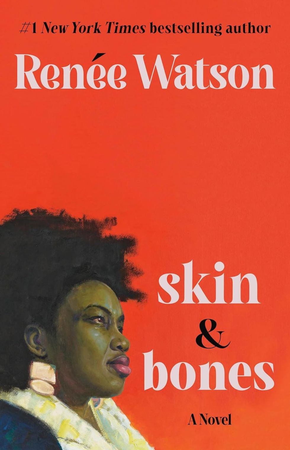 Skin & Bones by Ren\u00e9e Watson