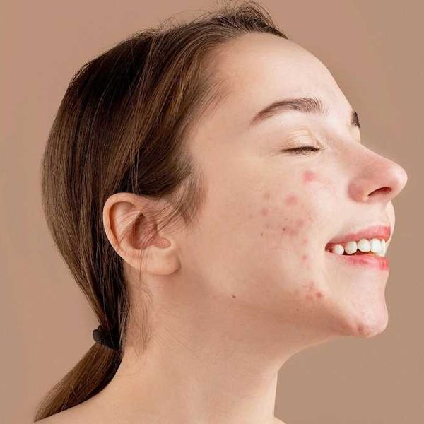 what your breakout means