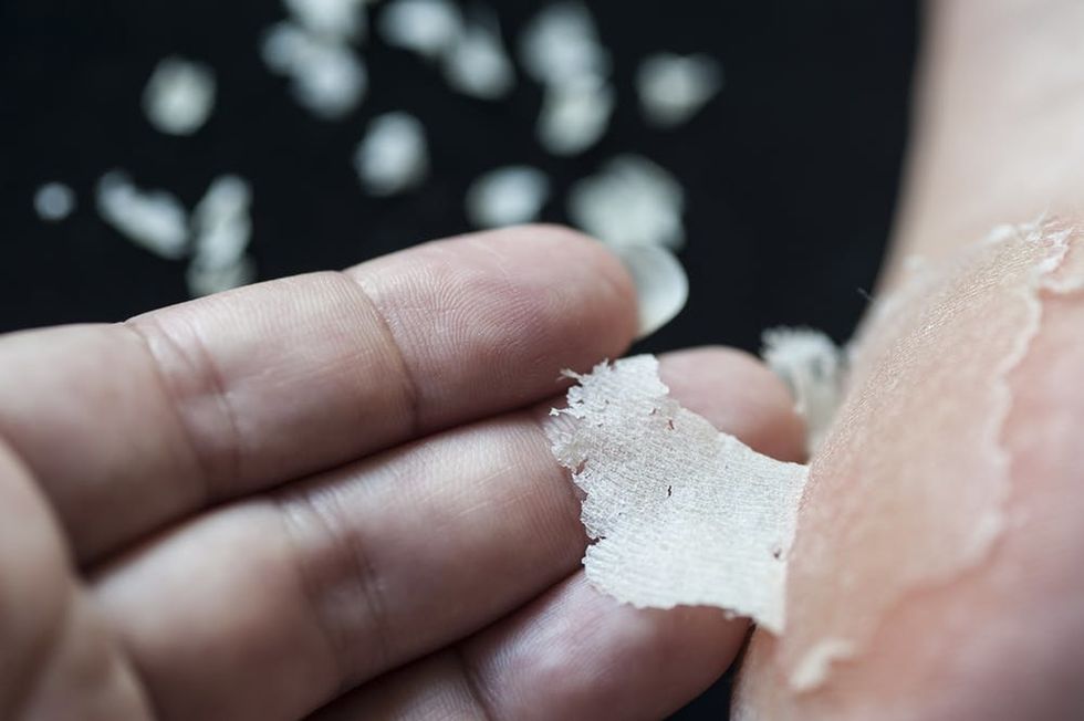 Woman holding peeling foot.