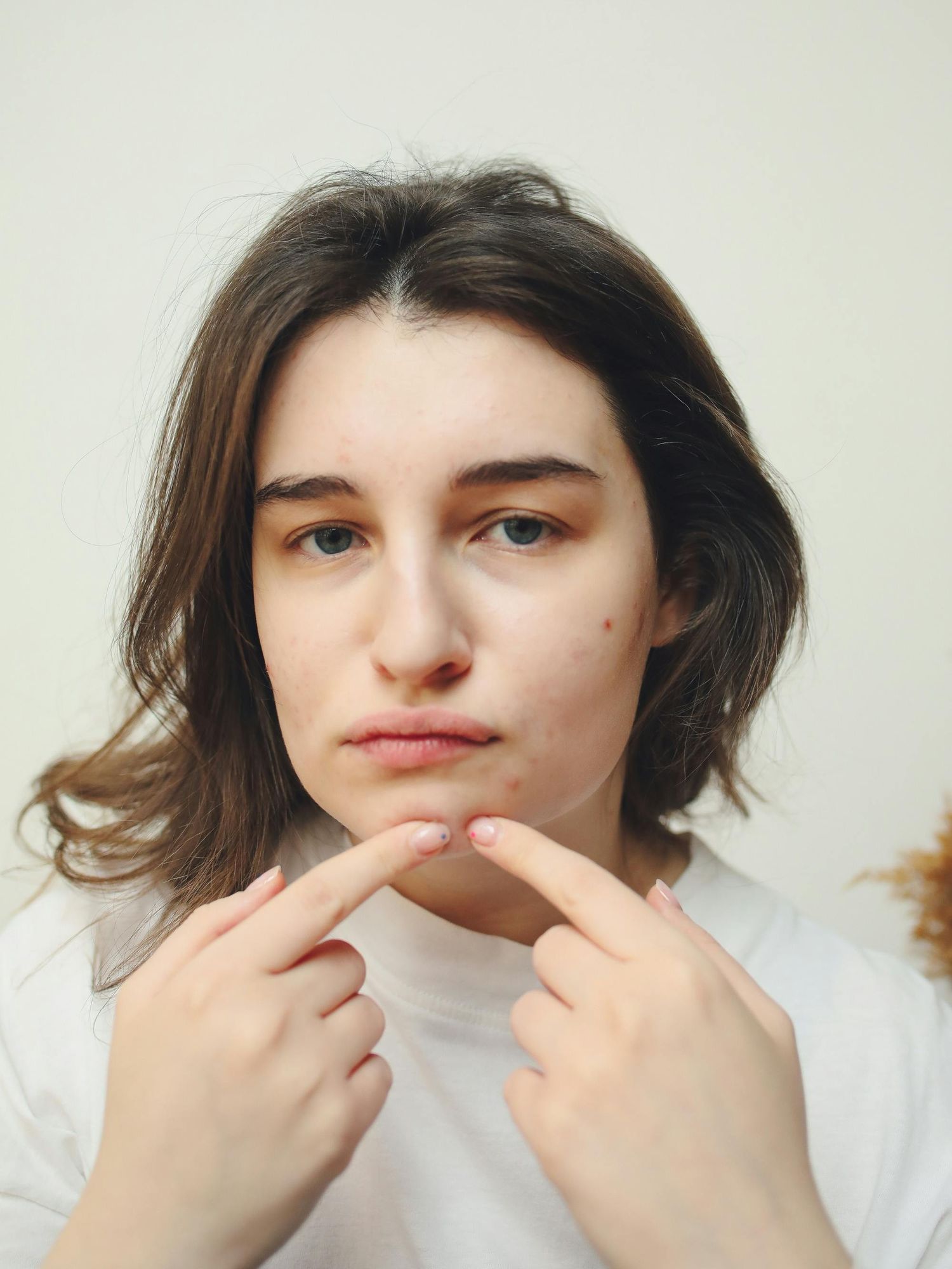 woman picking chin acne